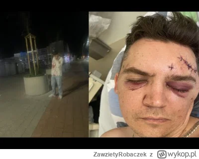 ZawzietyRobaczek - #szarpanki #patryk #drszarpanki #szarpankizzyciem update + fotki