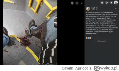 Gawith_Apricot - @Casuel: No nie było dotkliwe, wcale cw#lu
https://wykop.pl/cdn/c320...