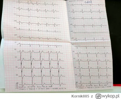 Kornik885 - #medycyna #ekg #kardiologia #kardiolog  Mamy tu jakiegoś szpenia od EKG? ...