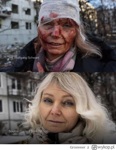 Grooveer - Dwa lata. Miała cztery operacje a ze wzrokiem dalej są problemy. Ale jest ...