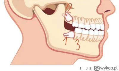 T__J - @DominiCanes 
Masz zęba:
1  całkiem zatrzymanego
2 częściowo zatrzymanego 
3 r...