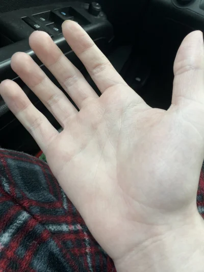 frugASS - łapy jak widelec