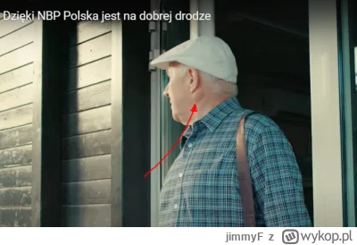 jimmyF - @SzitpostForReal: guz slinianki, albo wielki węzeł chłonny, niedobrze to wyg...