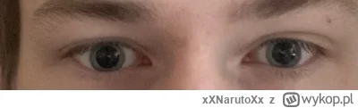 xXNarutoXx - Czy takie oczy po #snri są normalne? #ssri #leki #medycyna #przegryw