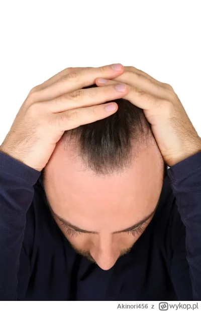 Akinori456 - Mam pytanko: Czy są jakieś specyfiki, maści, szampony i kij wie jeszcze ...