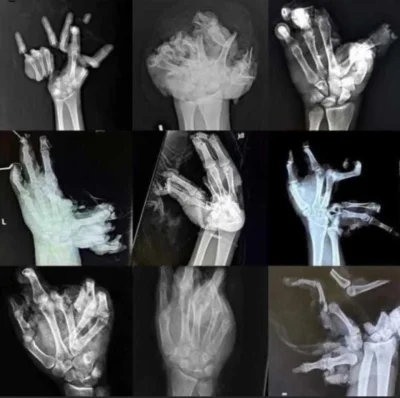 ffallen - @DziecizChoroszczy: