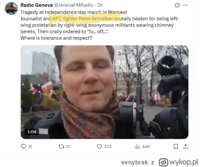 venybrak - #famemma xD