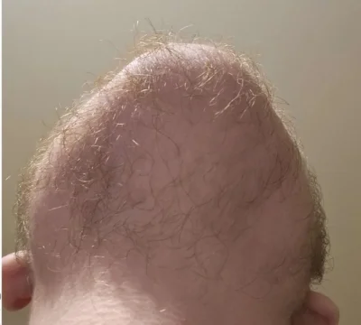 remlezar - @Ark00: Znowu obróciło, trochę dziwny kształt, ale trochę włosów jeszcze j...