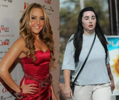 Rencistazprzypadku - Wykopki charakter jest najważniejszy , bo on z wiekiem nie przem...