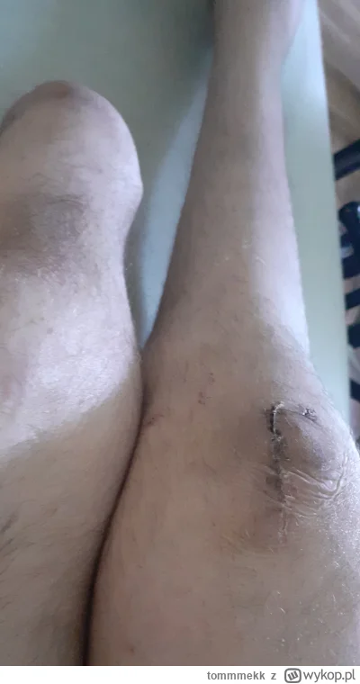 tommmekk - Bardzo Wam dziękuję Mirabelki i Mireczki
Za pomoc oraz wsparcie dla mojej ...