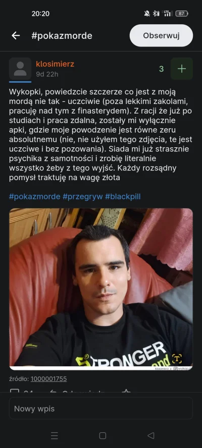 f.....x - @apfi facet 2/10 ma dużą deformację twarzy albo trwałe uszkodzenie po oparz...