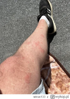 wirus133 - Chyba mnie komar ugryzł. #majowka #weekend #grill