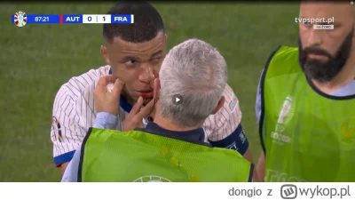 dongio - #mecz Kylian ze złamanym nosem