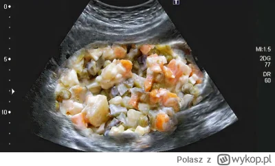 Polasz - @PIAN--A_A--KTYWNA: u mnie już tak ;)