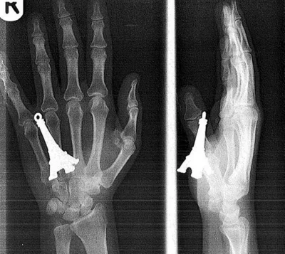 Neocaridina - @SotrazX: @nabbek