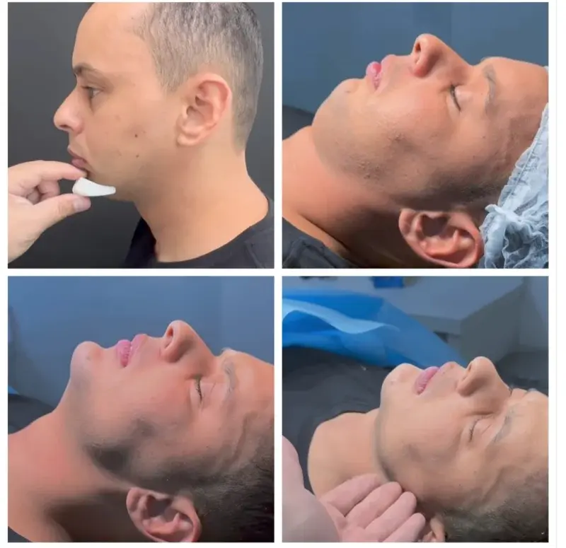 pomelobezkaca2 - #przegryw