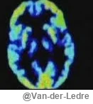 Van-der-Ledre - ...ehh.

#przegryw