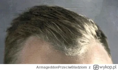 ArmageddonPrzeciwBladziom - @Zakala_Wadowic: @tmp1: A czyje to zakola? Do wygrania - ...