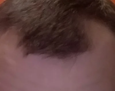 docent_fiutt - @Mandon: mam i dlatego najczęściej gole się na łyso