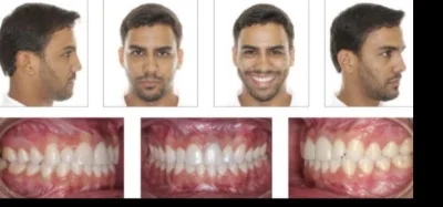 Dawid-01100 - @Arutam2002: Efekt po