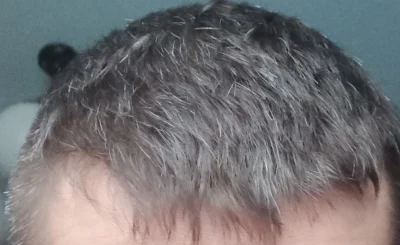 BialyMuszyn - #przegryw  over