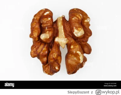 SlepyBazant - Oto zdjęcie płuc noworodka, którego rodzice używali kuchenki gazowej.

...