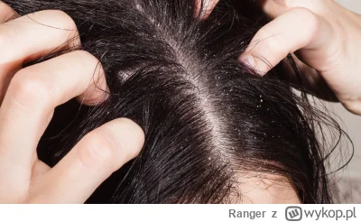 Ranger - Dobra wykopki, bo już mnie zaczyna to irytować - co na łupież dla chłopa 35l...