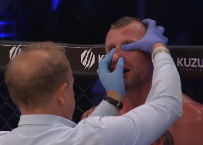 stokrocencjusz1 - #famemma Nawet lekarz/sędzia wczuł się w klimat. Nastawia nos jedno...