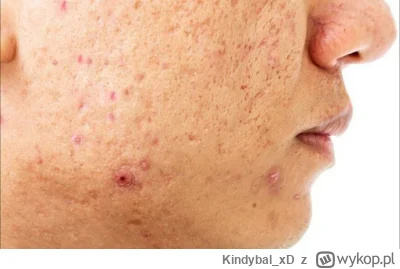 K.....D - @Tanczacy_chrzescijanin Okej