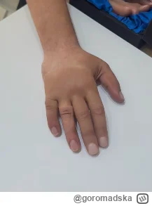 goromadska - Te czasy są jednak porąbane
Kiedyś iluzjoniści używali sztucznych dłoni,...