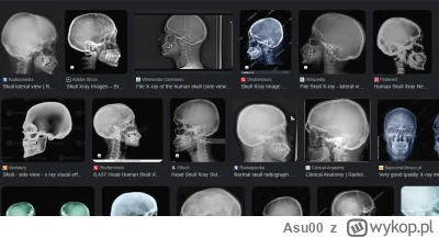 Asu00 - Czaszka ma zawsze owalny kształt, taka jest po protsu nasza natura. 
Potwierd...