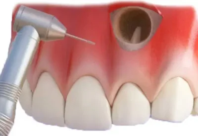luke-mat - @R-87: to zmień dentystę, na ból kodeina, a zrobić idzie wszystko. Myślisz...