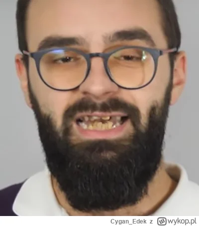 Cygan_Edek - lecą po tarkach aż plomby wypadają

#f1