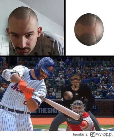 tasaku - mieć zaszyty łeb to jest akat teraz modne widzowie #bonzo #patostreamy