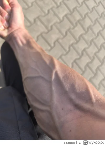 szamus1 - A u was waskularyzacja na jakim poziomie?
#mikrokoksy