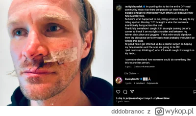 dddobranoc - Ale żenujący clicbait. Chop już zdążył dodać zdjęcie "po" na instagram, ...