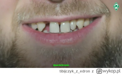 tibijczykzedron - #mecz