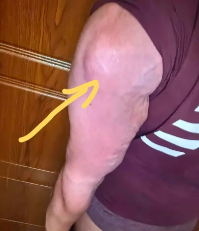 3m3m - #mirkokosy #doping
W skrócie, wróciłem po 3 latach na siłownię od  początku ro...