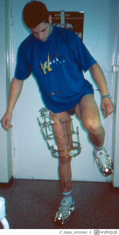 Zdupystrzelec - @zalp: 
A tutaj szyna zewnętrzna na kości udowej. Kość i mięśnie prze...