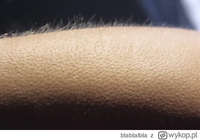 blablalbla - Deutschland, Deutschland über alles 
#mecz