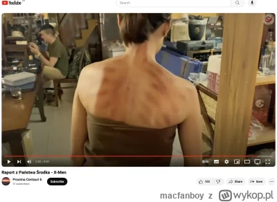 macfanboy - @-x_x-:  czy ona jest pobita na plecach?