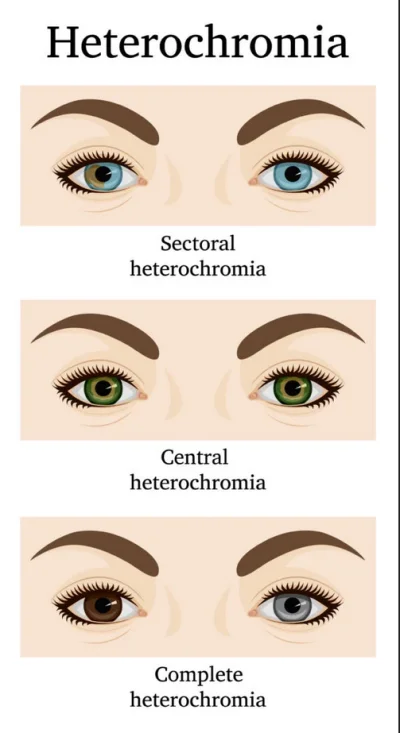 V.....3 - @opek_roztropek: Zielone z brązową heterochromią centralną. Czasem mówi się...