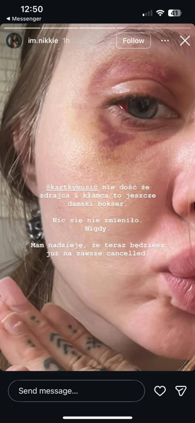 7uras - W #polskirap widzę nadal stabilnie 
#kartky #przemocdomowa