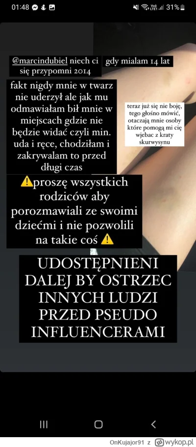 OnKujajor91 - #famemma #wardega #stuu #polskiyoutube #pandoragate #boxdel