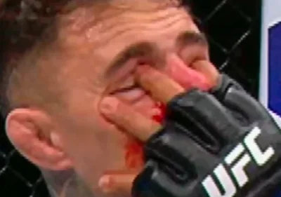 santiago123 - @zicogod:tak zwany double poke