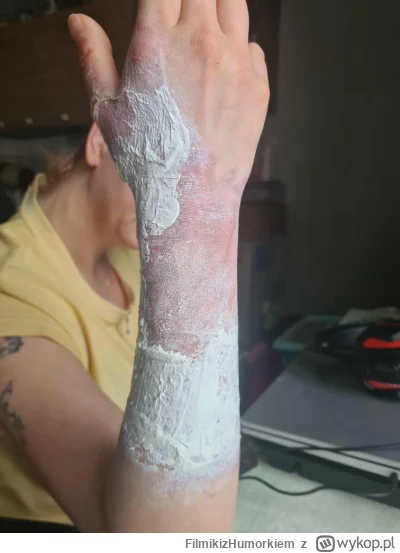 FilmikizHumorkiem - @FilmikizHumorkiem: opatrunek majonezowy