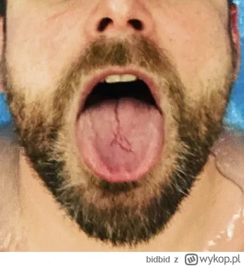 bidbid - Piękne wyparcie i wybielanie z odpowiedzialności na mlecznej k----e, festiwa...