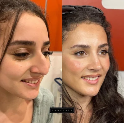 RitmoXL - #f1 Zobaczcie jaka krzywdę sobie ludzie robią - ładny cygański nos wyścigow...