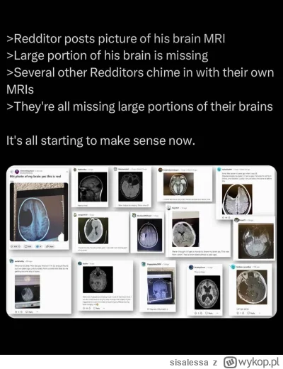 sisalessa - #reddit #heheszki