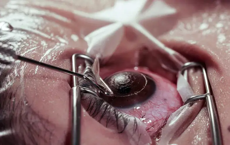 Orbiter01 - Ja wam powiem drogie wykopowiczki i wykopowicze jak zachować dobry wzrok ...